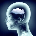 Migrañas, ¿son más frecuentes en verano?