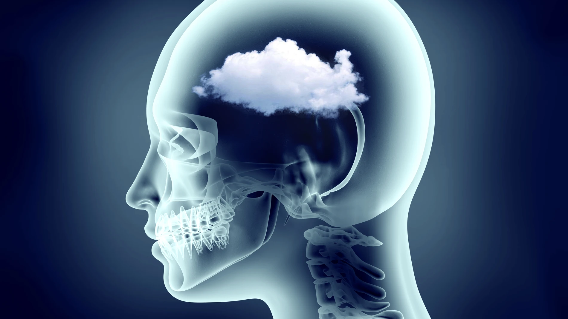 Migrañas, ¿son más frecuentes en verano?