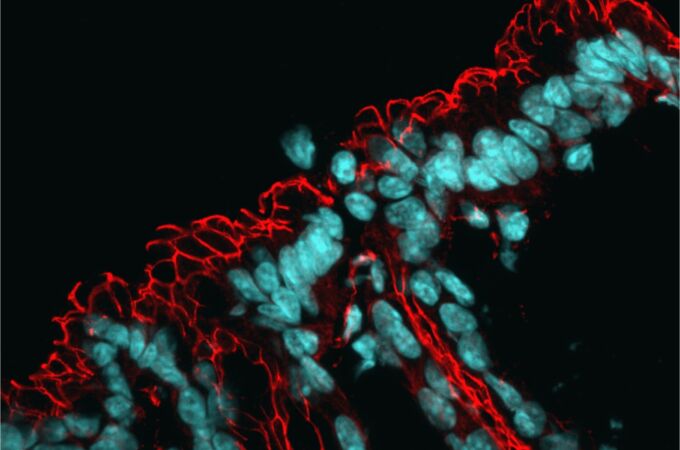 Microscopía del intestino, con los núcleos teñidos en azul y la red de proteínas de barrera en rojo