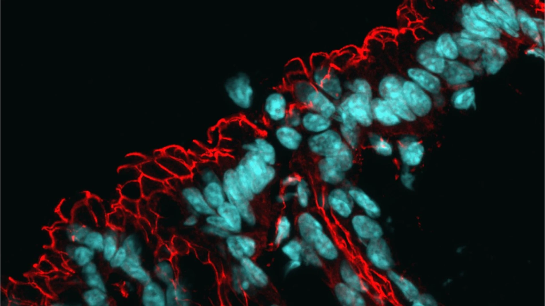 Microscopía del intestino, con los núcleos teñidos en azul y la red de proteínas de barrera en rojo