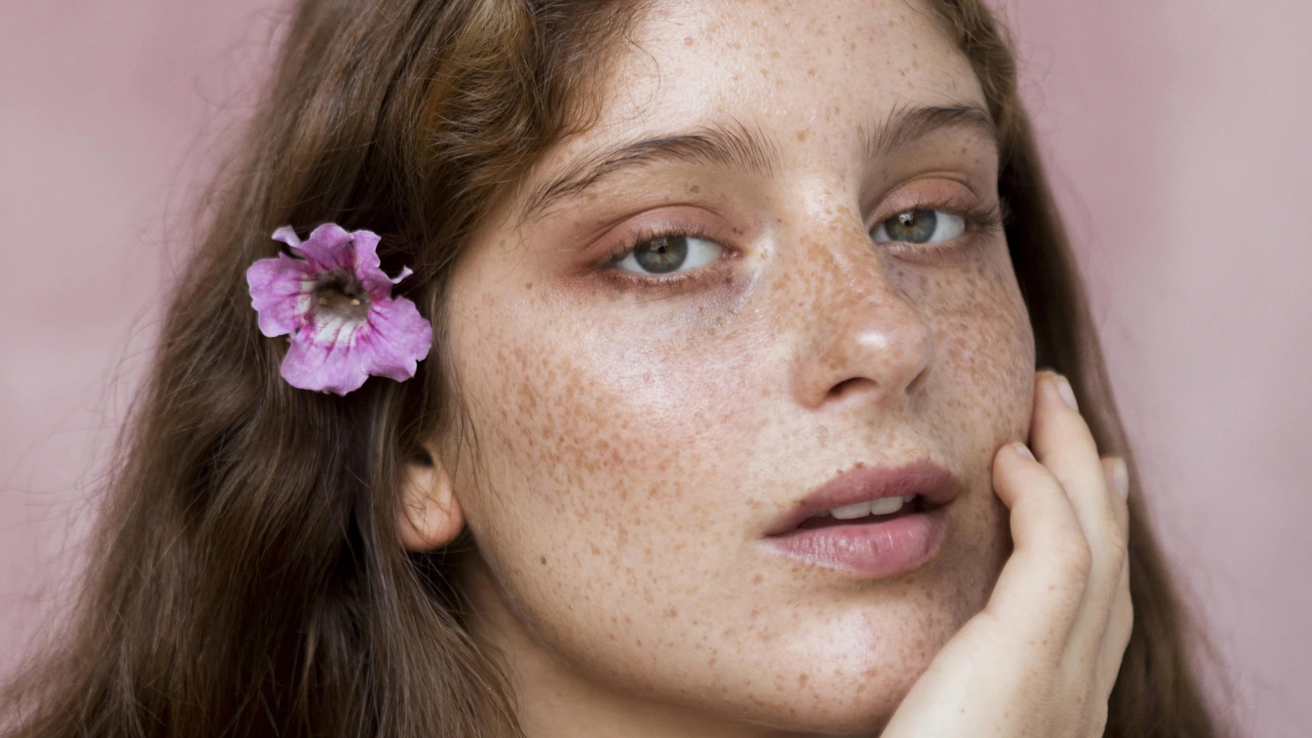 Primer plano de mujer con pecas y flor en el pelo, ilustrando la aparición de manchas solares en verano.