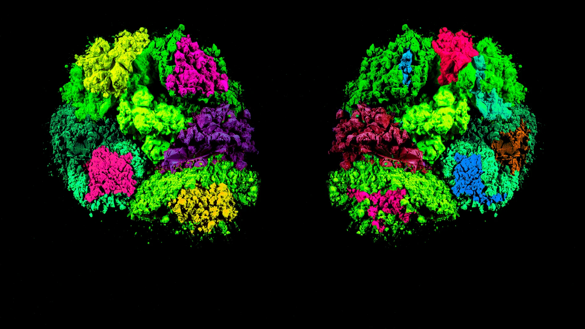 Representación del cerebro activado en zonas como el tálamo que pueden actuar sobre el autismo